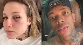 Ex-esposa de jogador do Palmeiras expõe hematomas e relata agressão